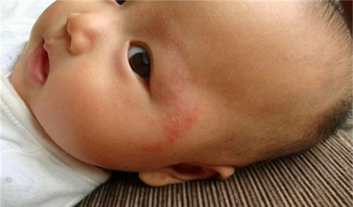 ������ʪ��ͼƬ ������ʪ����ô��